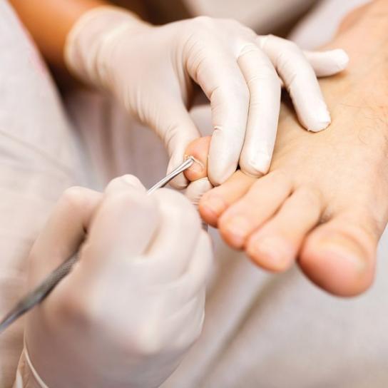 Soins de podologie Soins de podologie