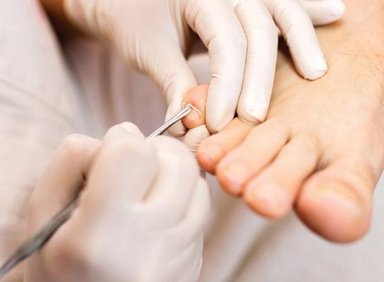 Soins de podologie Soins de podologie